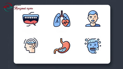 Симптомы наркотического отравления-инфографика